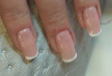 Behandling med tippar & Fransk