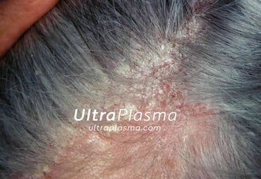 _ultra_plasma_ultra_plazma_ultra-plasma_ultra-plazma