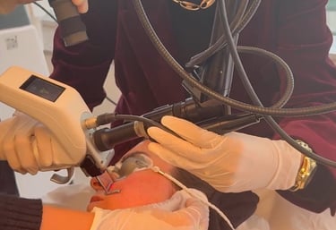 Youlaser MT e CO2 fracionado e Erbium Glass