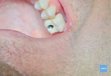 Paciente recibiendo atención odontológica en Badajoz