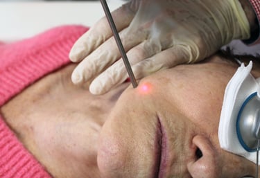 cabinet perma medical : mélasma et tâches pigmentaires