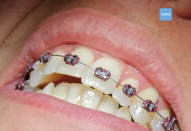 Revisión de ortodoncia en Clínica Dental ADES
