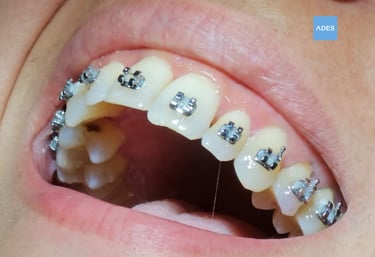 Niños en odontopediatría en Badajoz