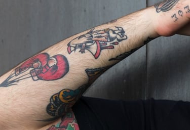 cabinet perma medical : détatouage