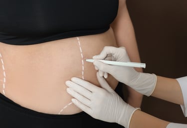 Dra. Lilyan Marissel - Cirugía Plástica y Estética - lipoabdoiminoplastia - contorno-corporal