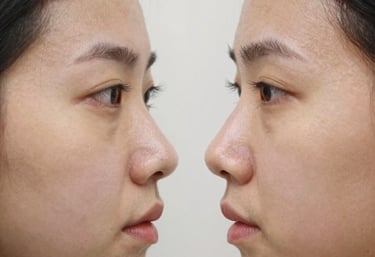 Before-and-after collage showcasing natural results from nose and eyelid surgeries.