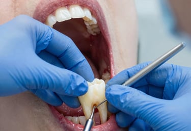 Close-up of sparkling white teeth reflecting light, symbolizing successful whitening treatment.