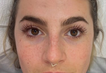 Taches de rousseur semi permanente résultat 1ère pose nez + pommettes sans retouche