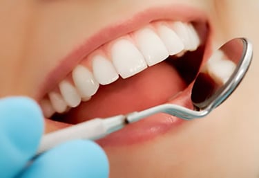 general dentistry in baner