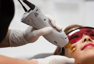 Laser Skin Treatments