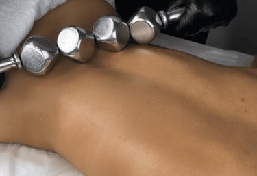 Un esthéticienne est en train de pratiquer la madero ice pour sculpter le corps