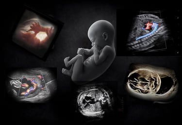 A 3D fetus illustration surrounded by prenatal ultrasound scans and doppler imaging shots.