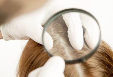 conducting hair and scalp assessments and evaluation for hair loss