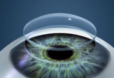 Trasplante de Córnea de Adultos y Niños en Guayaquil