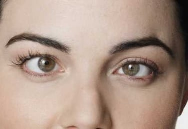 Tratamiento del Estrabismo en Guayaquil