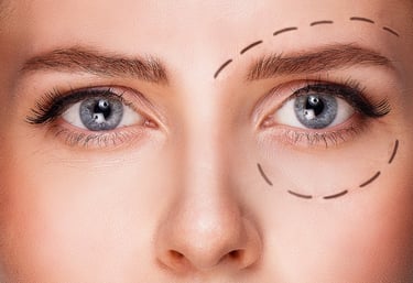 Cirugía Plástica Ocular u Oculoplastia en Guayaquil