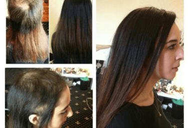 hair system maintenance