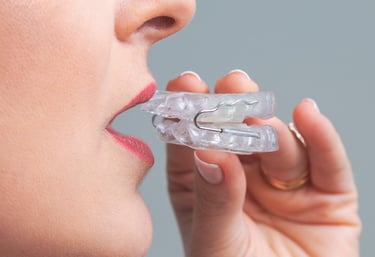 Tratamento odontológico para ronco e apneia do sono em Curitiba com aparelho intraoral.