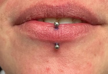 A vertical lip piercings, with a barbell
