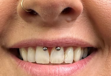 Smiley piercing