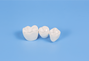 example of a dental bridge