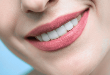 esthetic smile on a woman