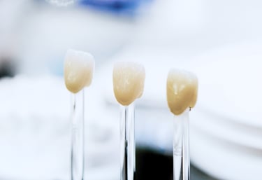 example of dental crowns