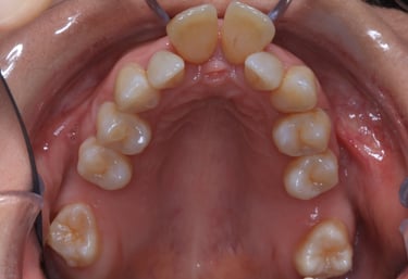 pictures of teeth