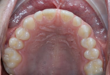 pictures of teeth