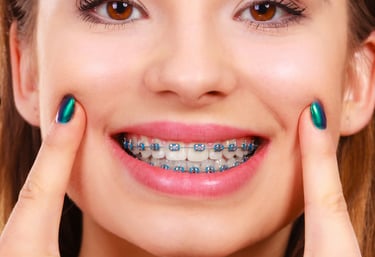 Jovem mostrando o resultado do aparelho ortodôntico colocado por dentista em Palmas especializado.