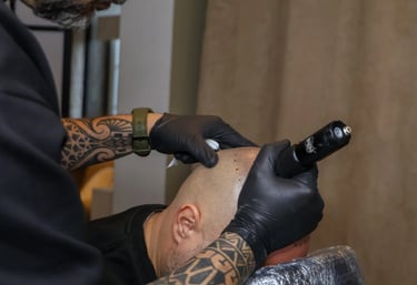 séance de micropigmentation capillaire sur un homme atteint de calvitie totale
