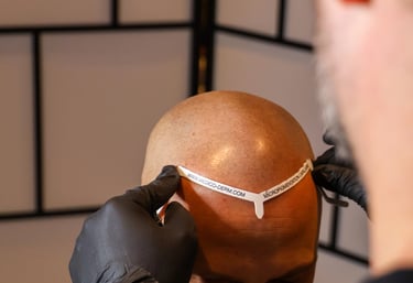 consultation de micropigmentation capillaire sur un homme chauve