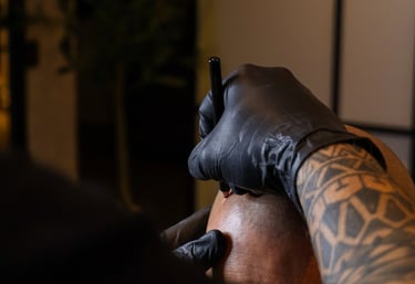 micropigmentation capillaire sur quelqu'un qui a une calvitie totale