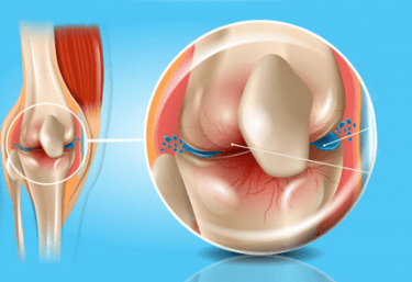 a medical illustration of a knee joint