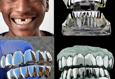 Grills argent sur mesure et couronnes chromées brillantes pour un sourire personnalisé