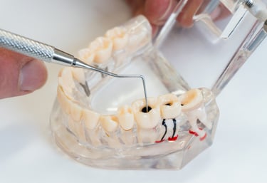 Dentist using a periodontal probe on a dental model to show tooth decay and cavities.