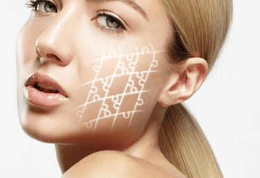 Regeneracion de tejidos