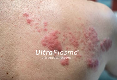 _ultra_plasma_ultra_plazma