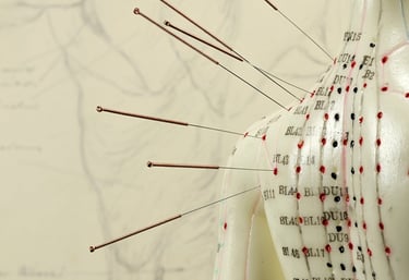 Image of acupuncture needles and figurine showing acupuncture points