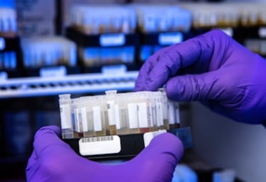 Laboratory technician processing diagnostic blood samples for neurological testing