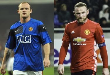 celebrities hair transplant wayne rooney