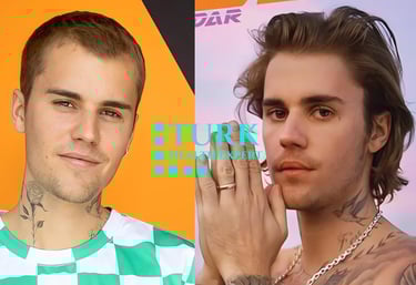 Justin Bieber hair transplant