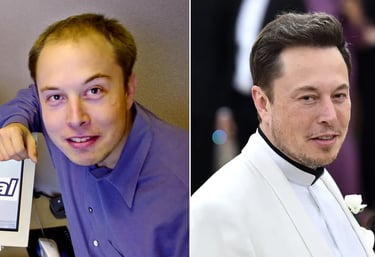 elon musk avat apres greffe capillaire