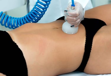 a woman in a bikini top and a man in a black underwear