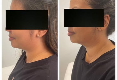 Natural enhancement before and after lip blushing procedure