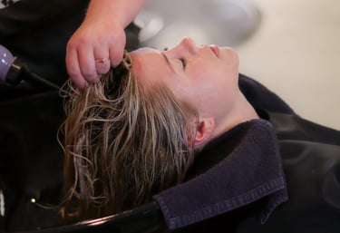 PRP hair restoration treatment in progress at Kandyan Aesthetics Kandy