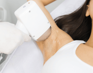 Épilation laser chez Insia Beauté – séance en clinique esthétique pour peau plus lisse