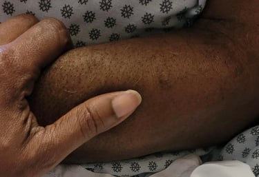 Photo of a patients arm being held by a hand.