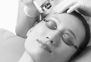 a woman getting a tattoo removed on her face