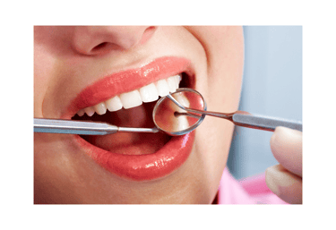 Close-up of a smiling woman with bright white teeth, showcasing a successful dental treatment in Tur